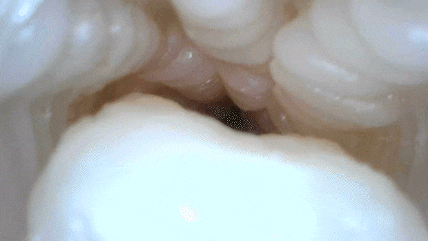 twinfinitysqueez003
