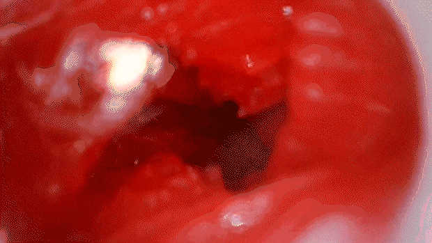 case02