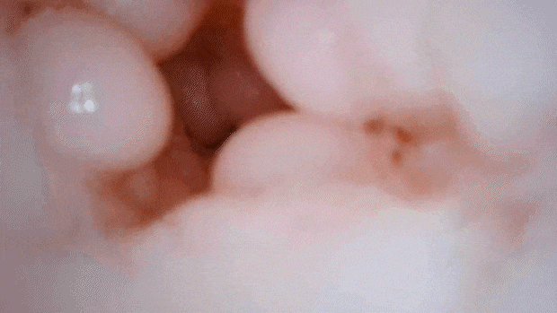 oshidasiinf001