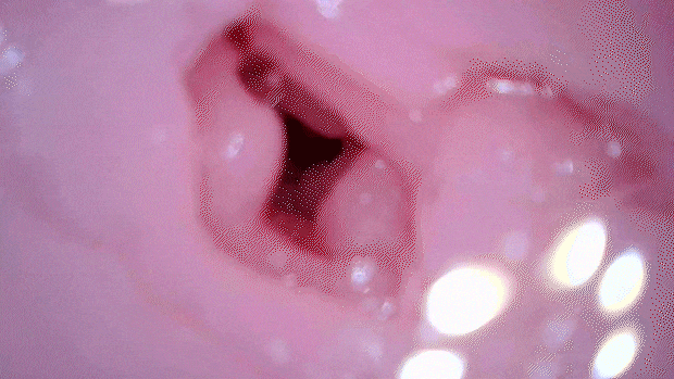 kairakunokiwami003