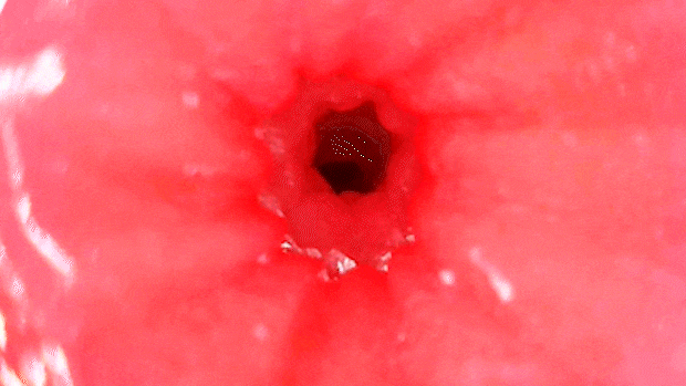 gokuhidanyurur006