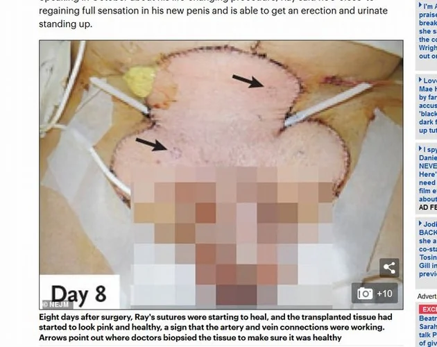 20191126_penis_01