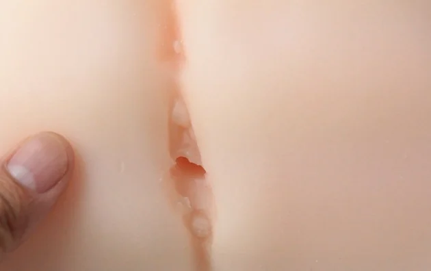 003