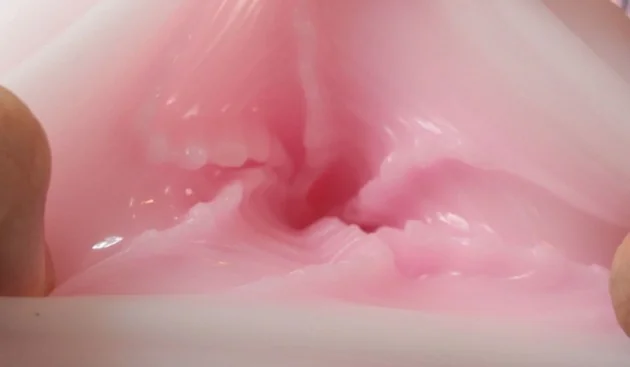 003