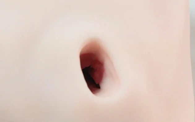 003