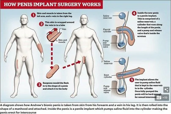 bionicmanhood3