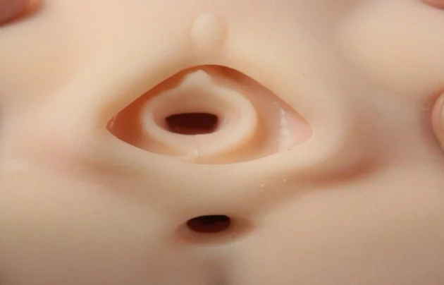 004