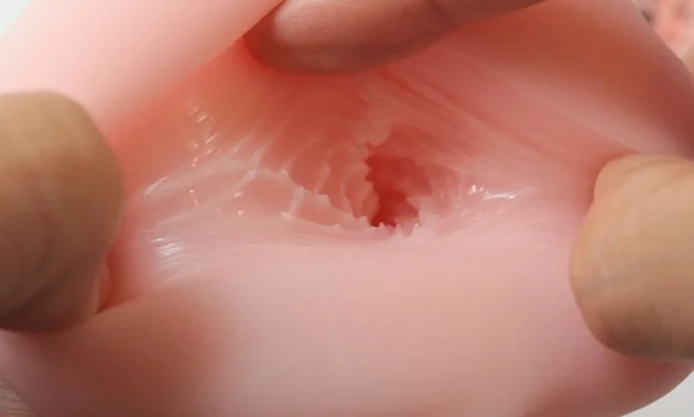 003