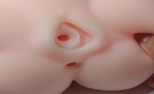 003